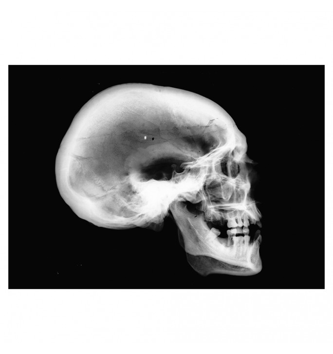 X-ray of a human skull.