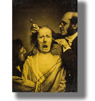 Frightened man undergoing electrical stimulation of his facial muscles while two doctors hold electrodes to his face.