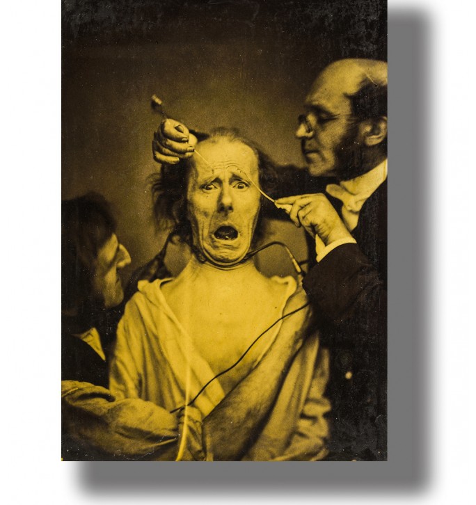 Frightened man undergoing electrical stimulation of his facial muscles while two doctors hold electrodes to his face.