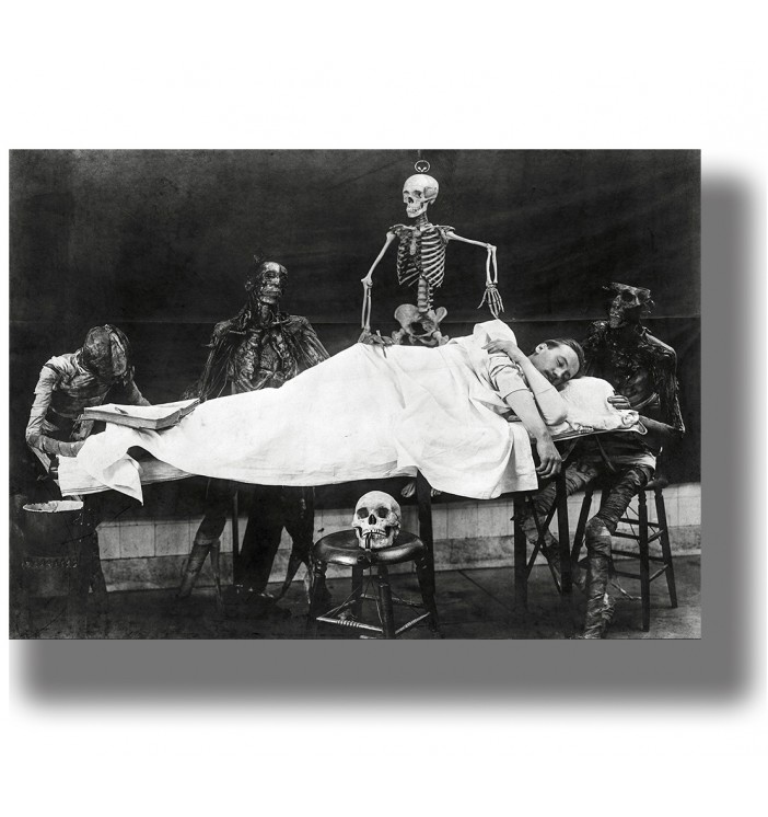 Antique black and white photo of skeletons and anatomical figures around a person lying on a table.