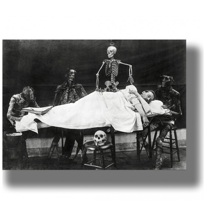 Antique black and white photo of skeletons and anatomical figures around a person lying on a table.