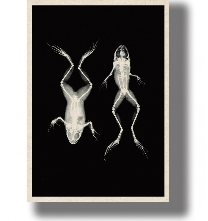 Vintage-style scientific image showing two frog skeleton x-rays, one from above and one from below.