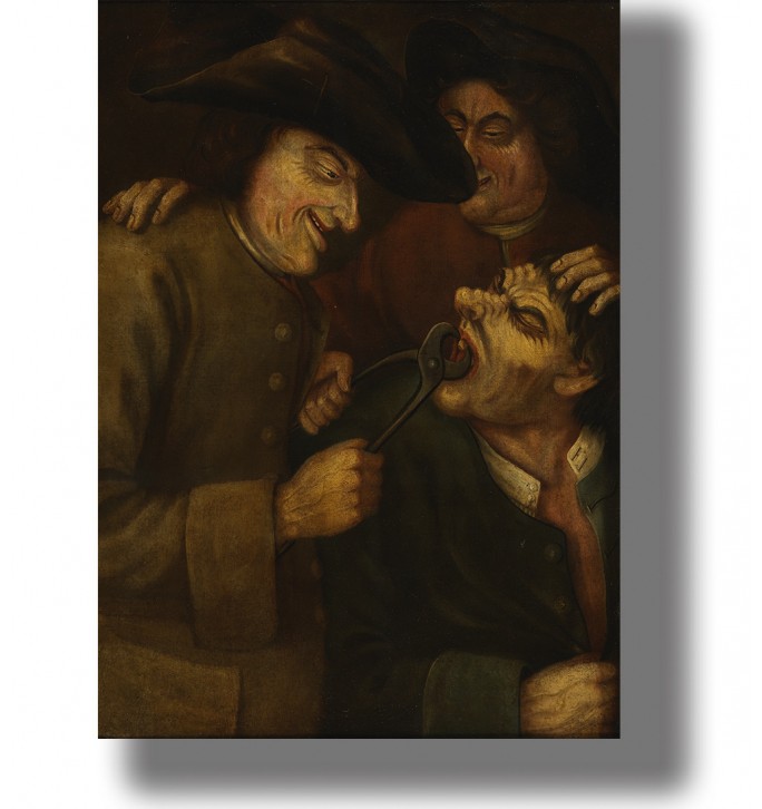 Vintage painting of a tooth being pulled by a blacksmith while two men hold the patient, in a dark baroque-style scene.